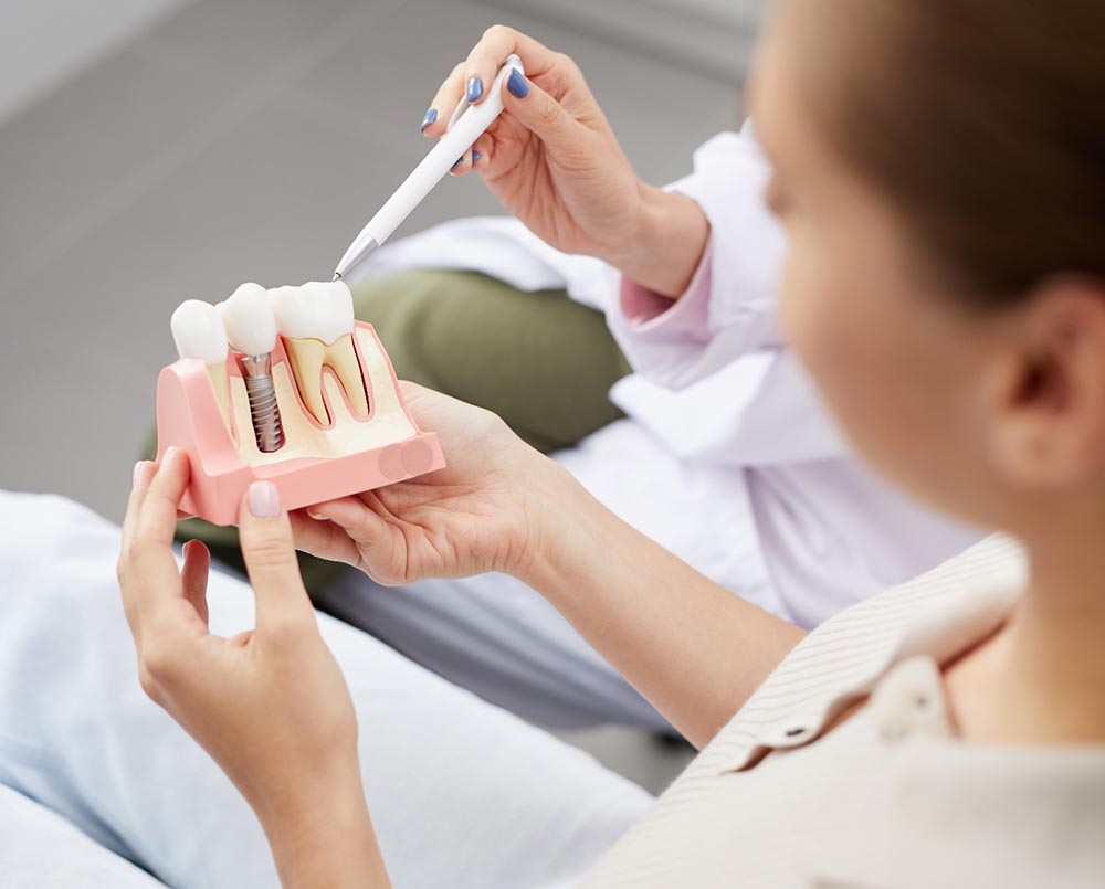 Impianti dentali realizzati dallo Studio Morandini